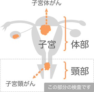 子宮頸がん検査（細胞診）